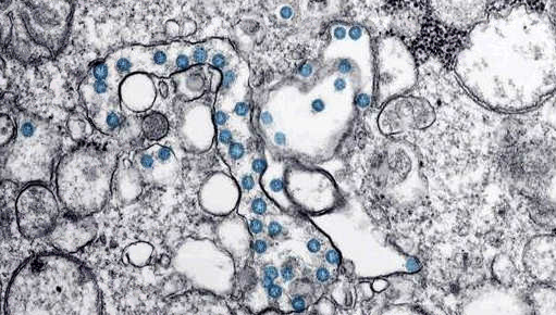 Investigadores del CSIC obtienen un nanomaterial que elimina el coronavirus y es aplicable en mascarillas y tejidos Investigadores del CSIC obtienen un nanomaterial que elimina el coronavirus y es aplicable en mascarillas y tejidos