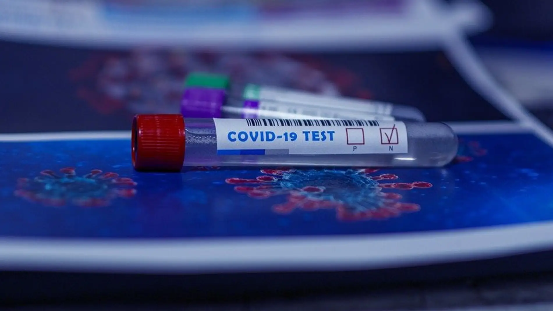 Test del coronavirus.