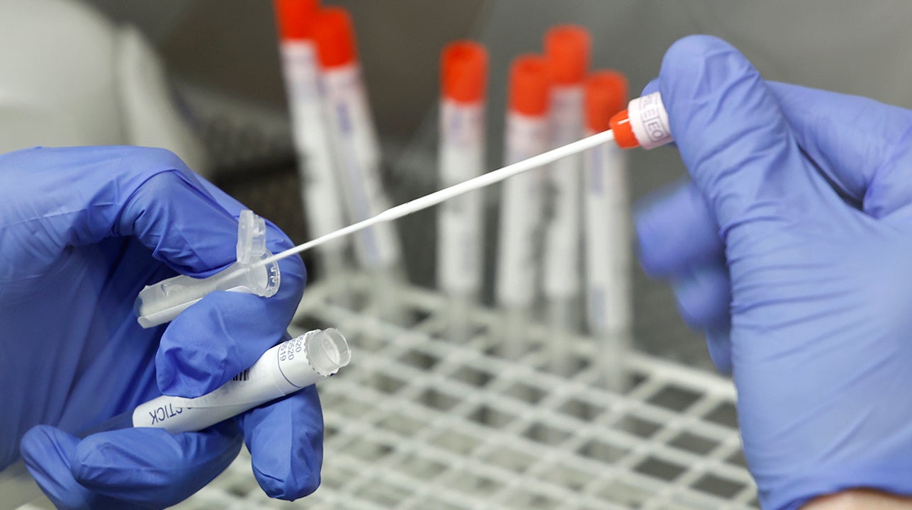 150 personas citadas para el cribado del brote de la Casa del Agua de Valdepeñas. 150 personas citadas para el cribado del brote de la Casa del Agua de Valdepeñas.