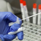 Test PCR