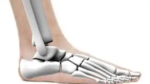 Huesos de cristal Huesos de cristal