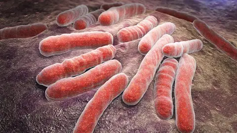 Bacterias infecciosas de tuberculosis bacterias infecciosas de tuberculosis