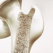 Última tecnología para el diagnóstico de la osteoporosis en la Policlínica Nuestra Señora del Rosario Última tecnología para el diagnóstico de la osteoporosis en la Policlínica Nuestra Señora del Rosario