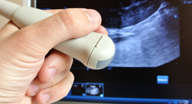 El Defensor del Paciente pide a la Fiscalía que investigue si la CARM envía a mujeres que quieren abortar a otras comunidades El Defensor del Paciente pide a la Fiscalía que investigue si la CARM envía a mujeres que quieren abortar a otras comunidades