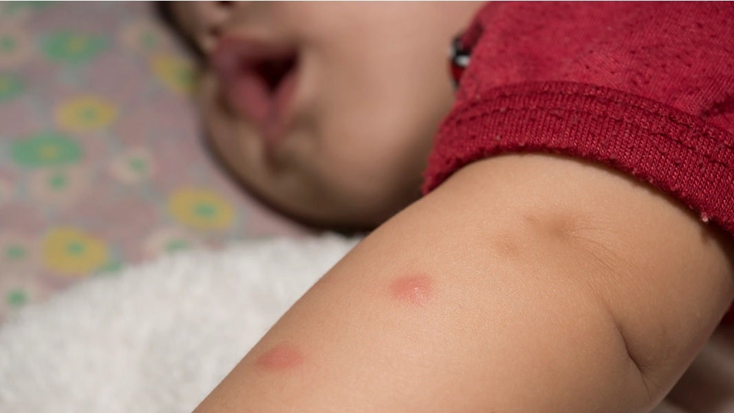 01x19: Protección frente a los insectos 01x19: Protección frente a los insectos