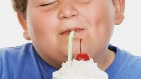 Obesidad Obesidad
