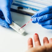 El test de anticuerpos permite confirmar sin la vacuna es efectiva en un organismo