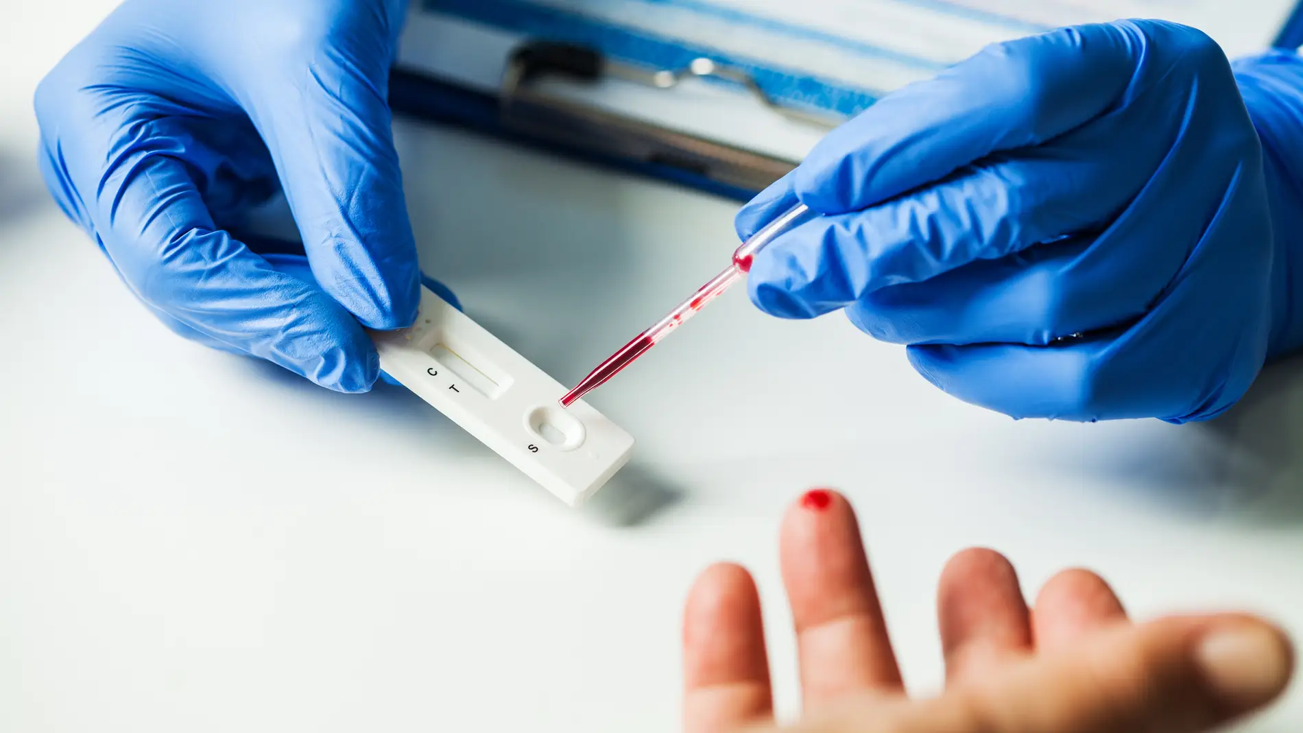 El test de anticuerpos permite confirmar sin la vacuna es efectiva en un organismo