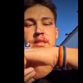 Un camarero de Huelva denuncia una agresión LGTBfóbica al grito de "maricón de mierda"