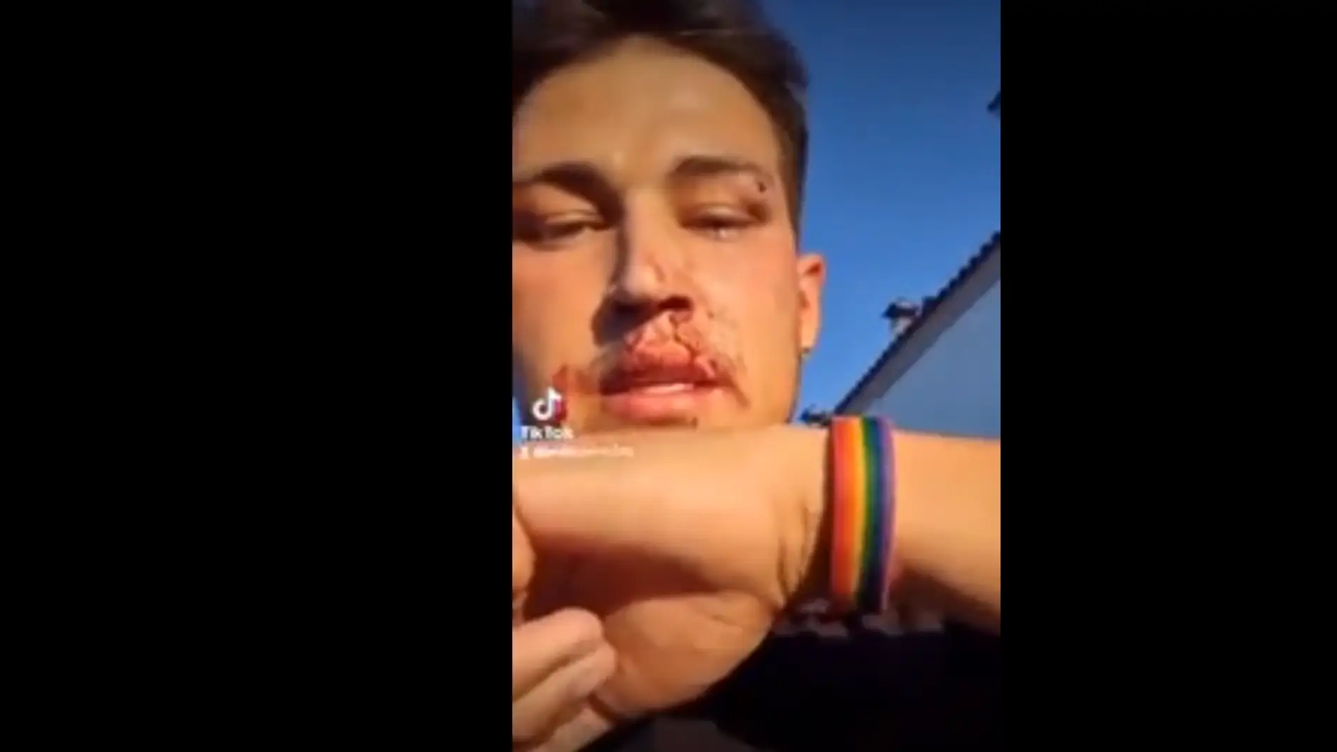 Un camarero de Huelva denuncia una agresión LGTBfóbica al grito de "maricón de mierda"