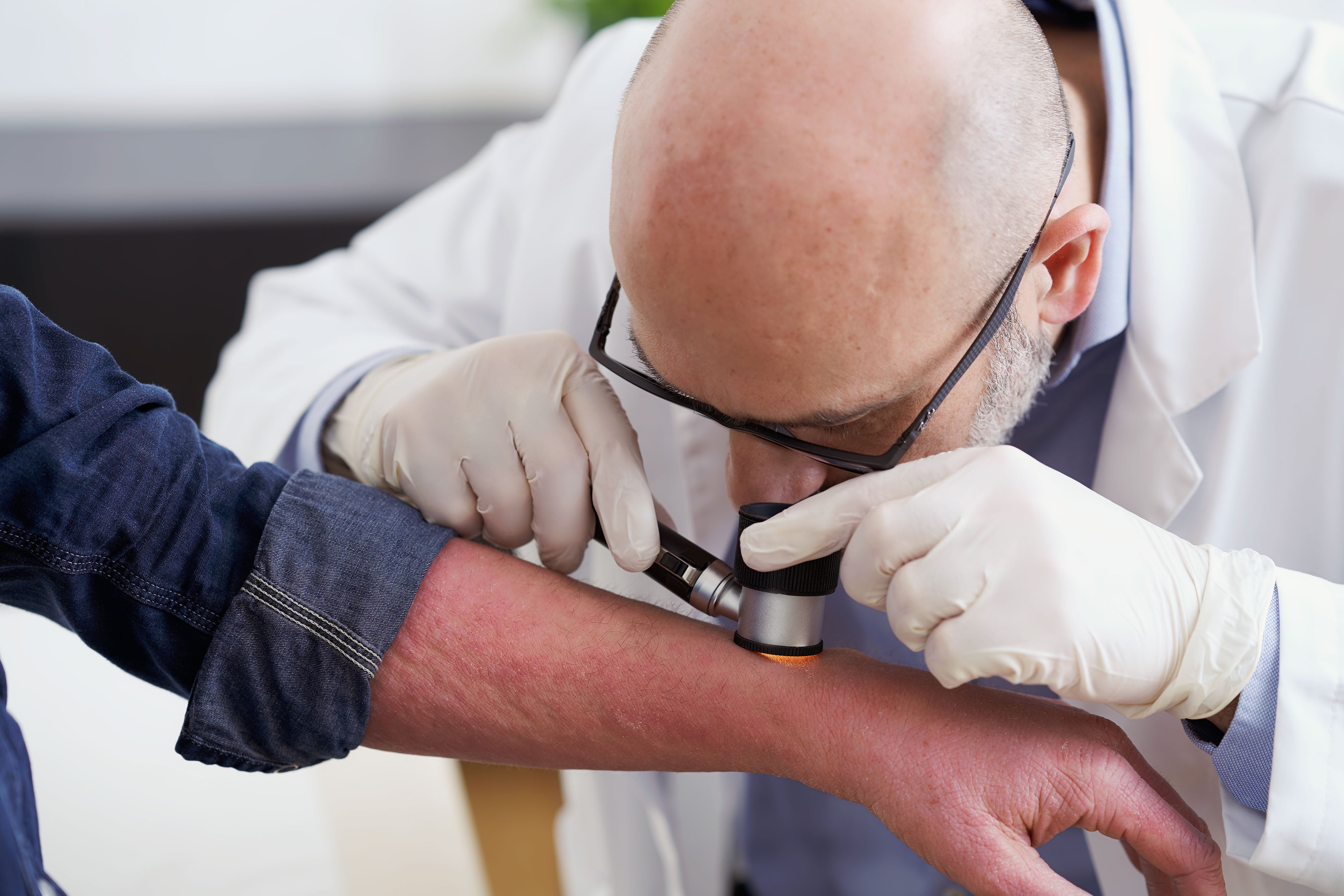 La sanidad alicantina participa en un ensayo clínico dermatológico a nivel internacional La sanidad alicantina participa en un ensayo clínico dermatológico a nivel internacional