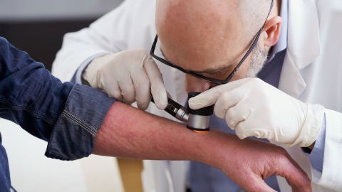 M&eacute;dico observando infecci&oacute;n cut&aacute;nea