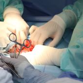 Una operación de trasplante de órganos en un quirófano