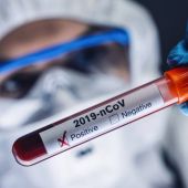 Dos estudios asocian nuevos defectos geneticos e inmunologicos con la covid grave