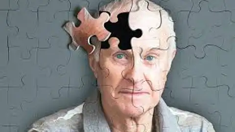 Alzheimer Asociación