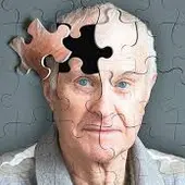 Alzheimer Alzheimer