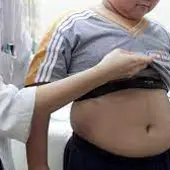 Más de un 20% de los menores aragoneses también sufren de obesidad Más de un 20% de los menores aragoneses también sufren de obesidad