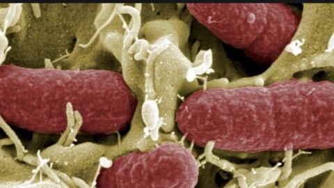 S&uacute;per bacteria