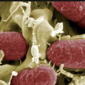 Súper bacteria
