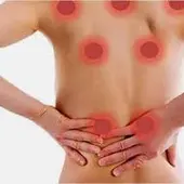 El dolor en mujeres con fibromialgia. Puntos de dolor El dolor en mujeres con fibromialgia. Puntos de dolor