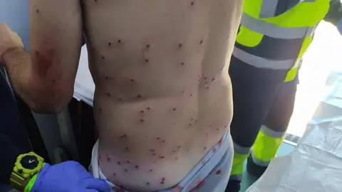 Heridas en las espalda provocadas por el disparo Heridas en las espalda provocadas por el disparo