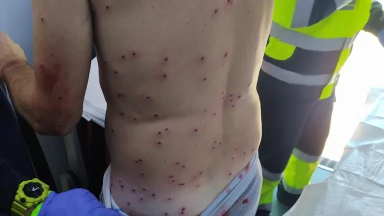 Heridas en las espalda provocadas por el disparo Heridas en las espalda provocadas por el disparo