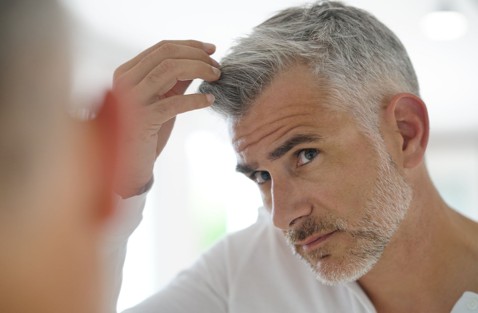 Descubre las últimas técnicas y avances para prevenir y tratar la alopecia Descubre las últimas técnicas y avances para prevenir y tratar la alopecia