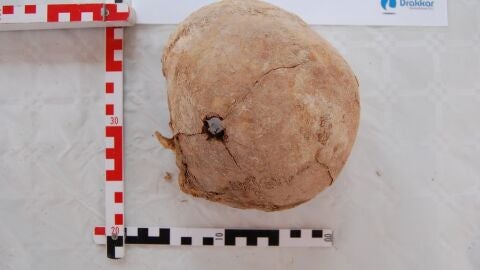 Uno de los restos encontrados con un impacto de bala Uno de los restos encontrados con un impacto de bala