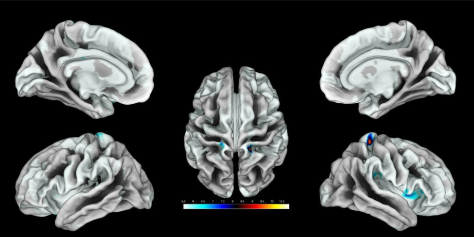 Juan Lerma: "Hay que investigar qué ocurre dentro del cerebro de alguien con poder para que decida aplastar un país" Juan Lerma: "Hay que investigar qué ocurre dentro del cerebro de alguien con poder para que decida aplastar un país"