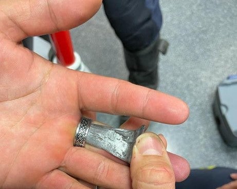 VIDEO: Bomberos y sanitarios de Tomelloso extraen el anillo de un dedo de un adolescente VIDEO: Bomberos y sanitarios de Tomelloso extraen el anillo de un dedo de un adolescente