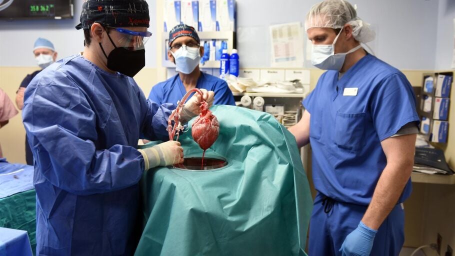 Fotograf&iacute;a cedida por la Facultad de Medicina de la Universidad de Maryland (EE.UU.) que muestra al cirujano Muhammad M. Mohiuddin (c) liderando un equipo mientras manejan un coraz&oacute;n cerdo gen&eacute;ticamente modificado en el Centro M&eacute;dico de la Universidad de Maryland en Baltimore, Maryland (EE.UU.)
