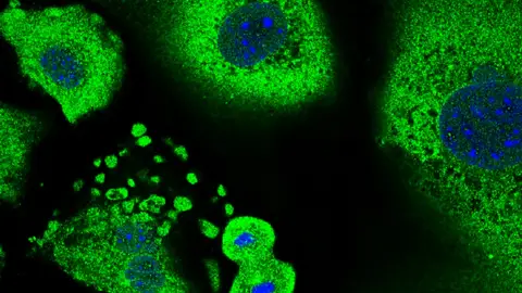 Descubren como funciona la primera linea de defensa contra el cancer de piel Descubren como funciona la primera linea de defensa contra el cancer de piel