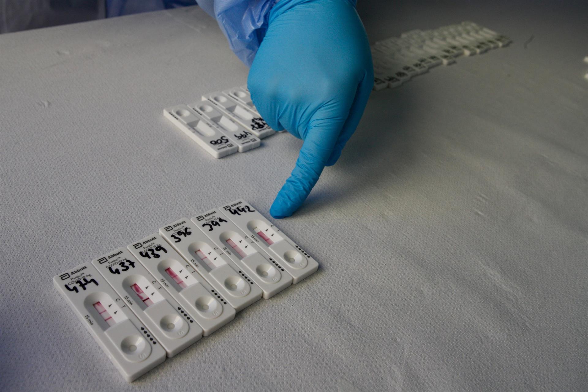 La sexta ola sigue su lento descenso en Euskadi, con 75 fallecidos la última semana La sexta ola sigue su lento descenso en Euskadi, con 75 fallecidos la última semana