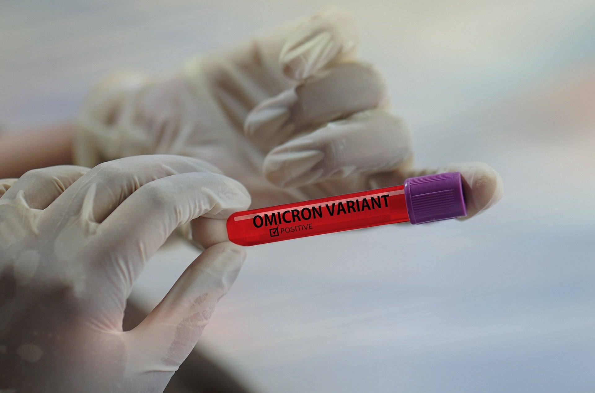 La variante Ómicron está detrás del 88% de los contagios en Aragón La variante Ómicron está detrás del 88% de los contagios en Aragón