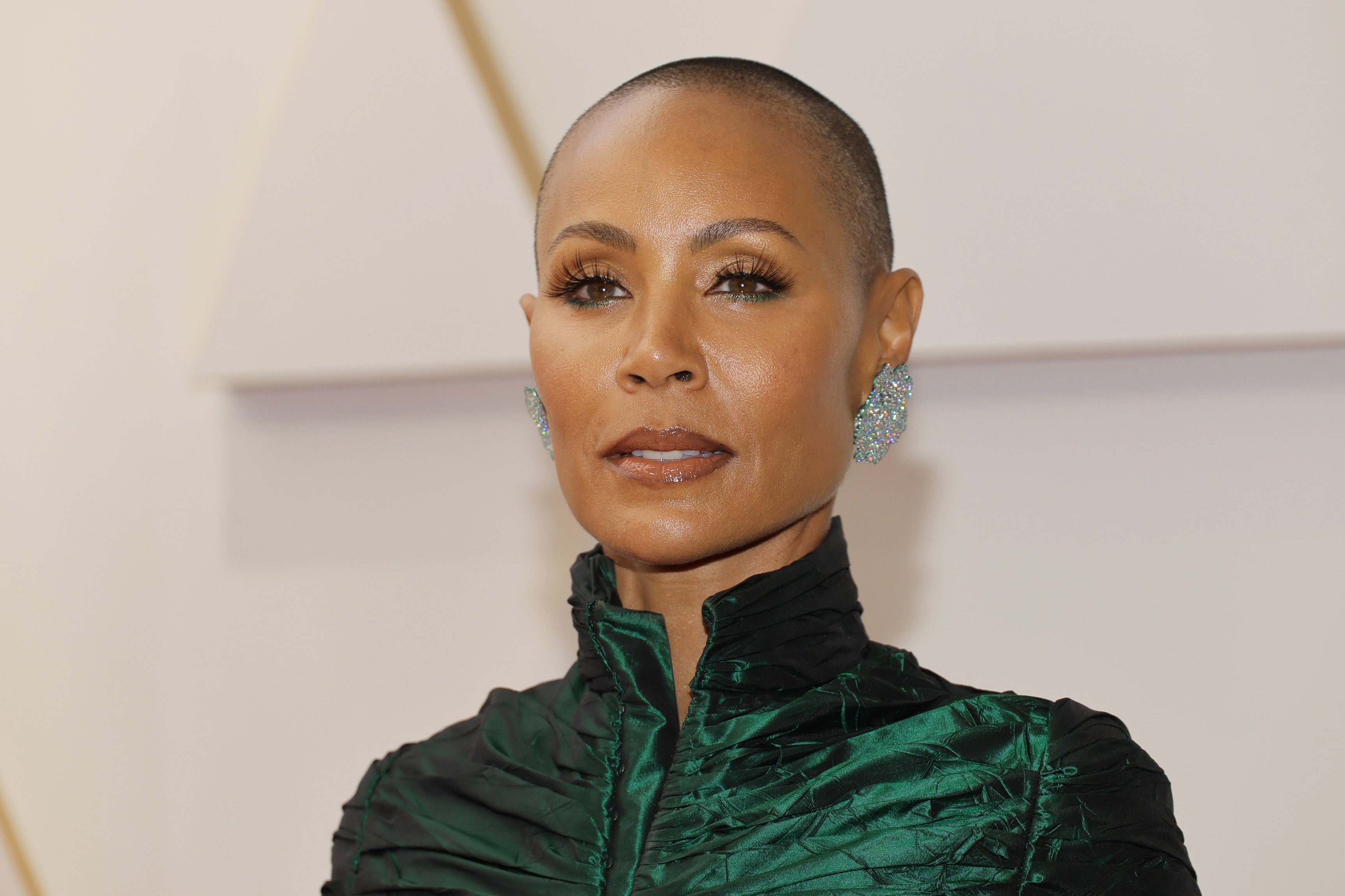 Jada Pinkett no es la única: Otras famosas que también sufren alopecia Jada Pinkett no es la única: Otras famosas que también sufren alopecia