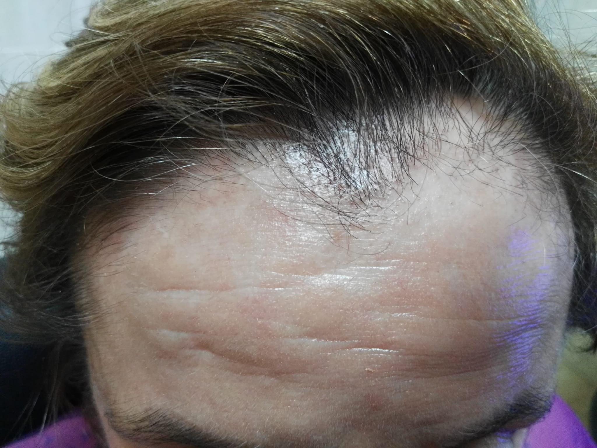 Encarnita Martínez, "En Primavera es más importante conocer nuestra salud capilar" Encarnita Martínez, "En Primavera es más importante conocer nuestra salud capilar"