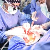 Sanitarios en plena implantación de órganos