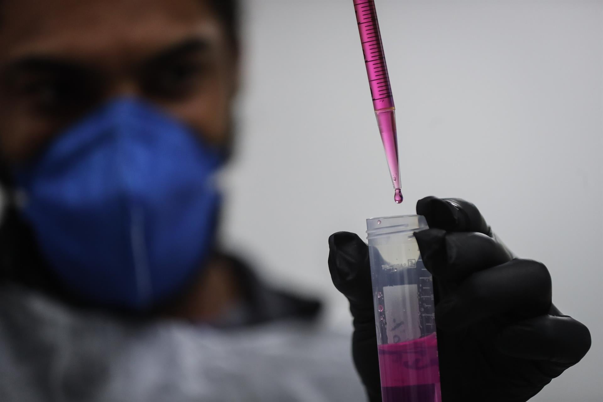 Los casos de hepatitis infantil aguda ascienden a 190 Los casos de hepatitis infantil aguda ascienden a 190