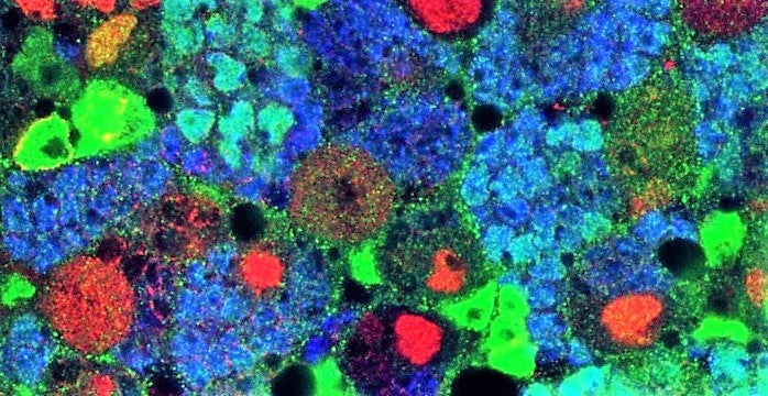El Instituto de Neurociencias de la UMH de Elche identifica una nueva función de unas moléculas que podría llevar a comprender mejor el cáncer El Instituto de Neurociencias de la UMH de Elche identifica una nueva función de unas moléculas que podría llevar a comprender mejor el cáncer