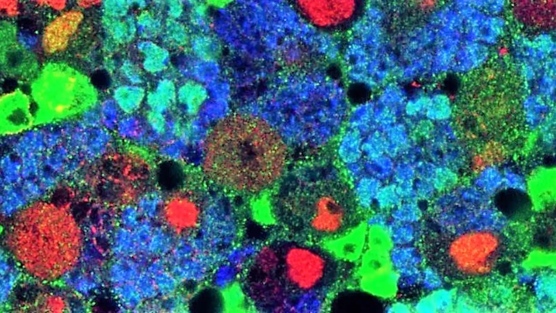 El Instituto de Neurociencias de la UMH de Elche identifica la nueva función de unas moléculas que podría llevar a comprender mejor el cáncer.