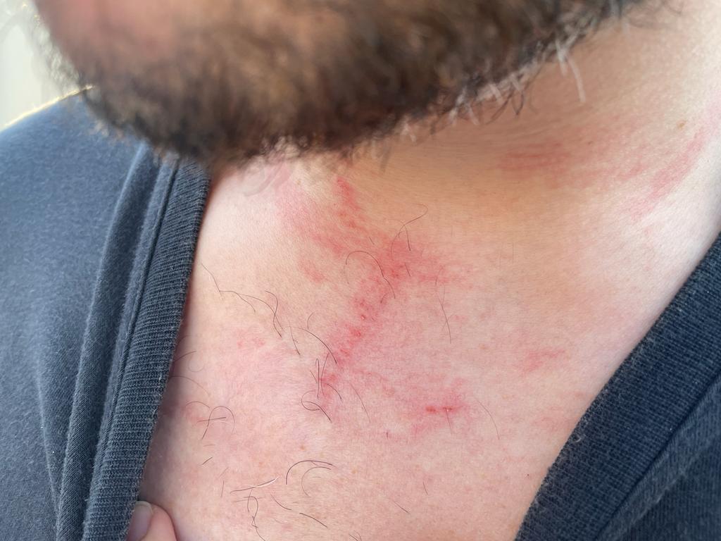 Denuncian al alcalde de Pol por agresión en un partido de fútbol Denuncian al alcalde de Pol por agresión en un partido de fútbol