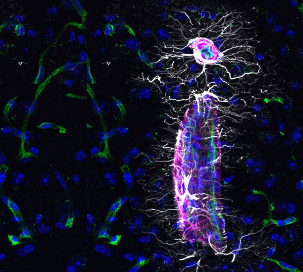 Científicos descubren una molécula que permite rejuvenecer el cerebro y recuperar memoria en ratones Científicos descubren una molécula que permite rejuvenecer el cerebro y recuperar memoria en ratones