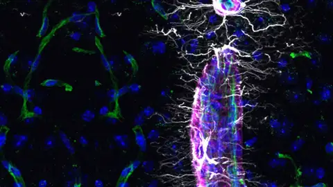 Científicos descubren una molécula que permite rejuvenecer el cerebro y recuperar memoria en ratones