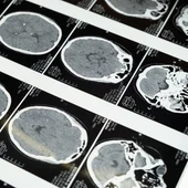 ¿Hay que poner límites a los estudios del cerebro? | Foto: Pexels ¿Hay que poner límites a los estudios del cerebro? | Foto: Pexels