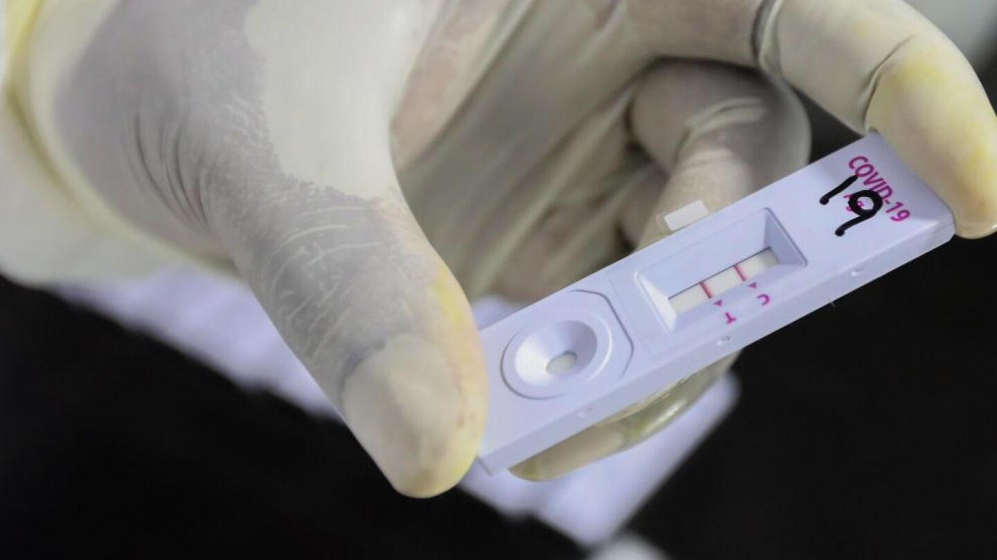 Variante Covid XE: los nuevos s&iacute;ntomas de la variante invisible a los test