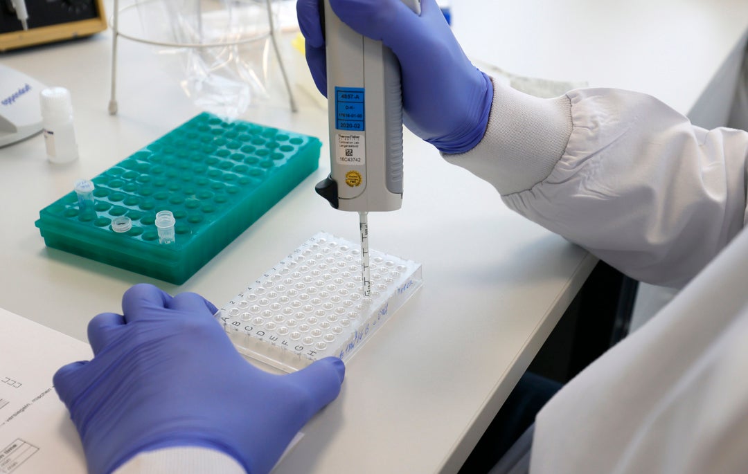 Madrid inicia este lunes el uso de pruebas PCR para detectar la viruela del mono Madrid inicia este lunes el uso de pruebas PCR para detectar la viruela del mono