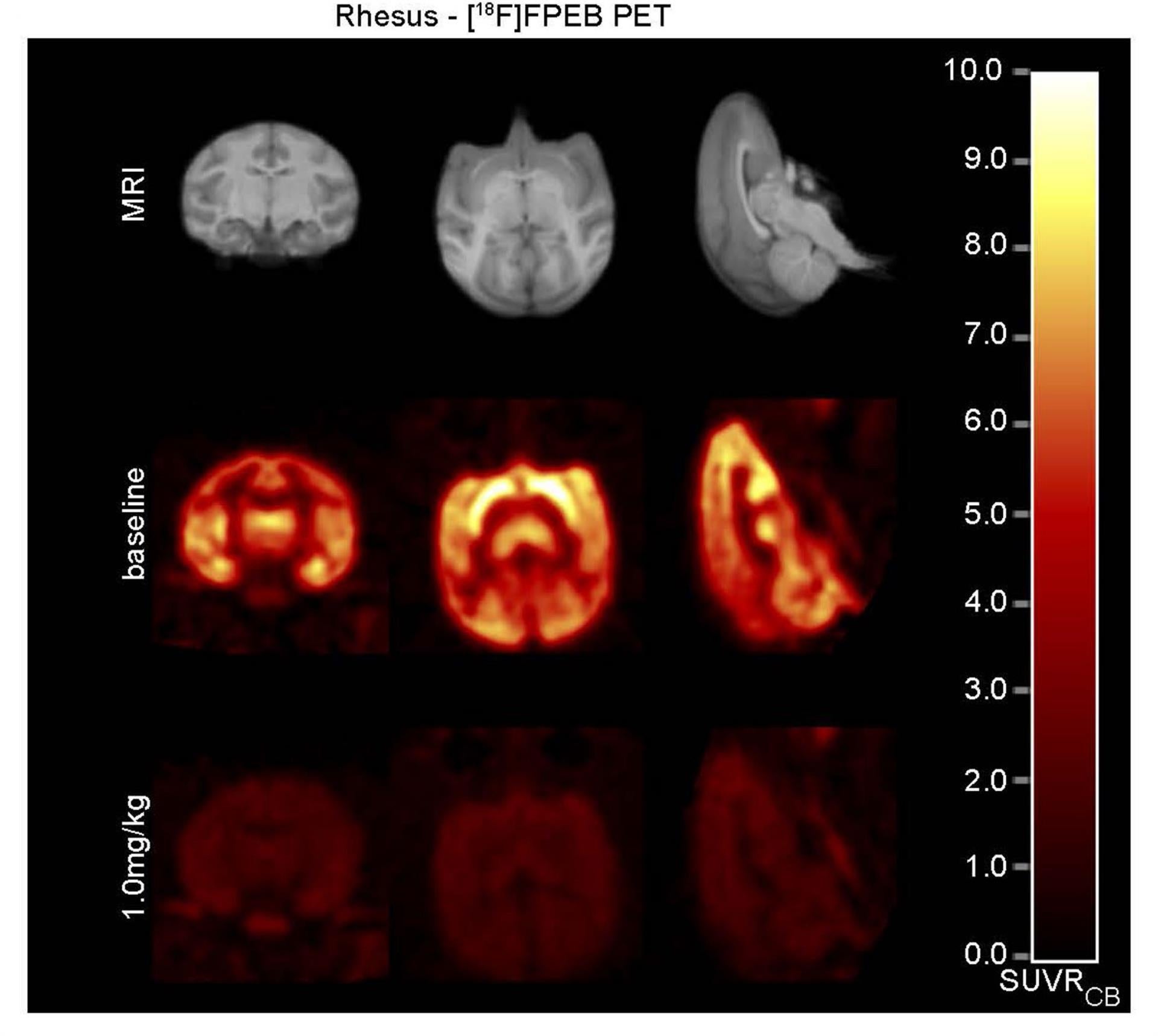 Nuevo avance contra el Alzheimer: un fármaco probado en ratones revierte daños neuronales Nuevo avance contra el Alzheimer: un fármaco probado en ratones revierte daños neuronales