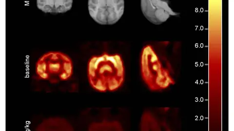 Imágenes de resonancia magnética y de una tomografía de un mono antes y después de recibir el BMS-984923