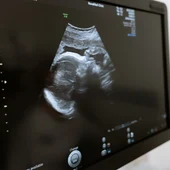 Imagen de archivo de una ecografía Imagen de archivo de una ecografía