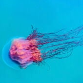 Picaduras de medusas: tipos, síntomas y tratamientos